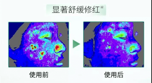 美国|美国OHBT山茶花水乳到底有没有效果？能不能美白祛痘？