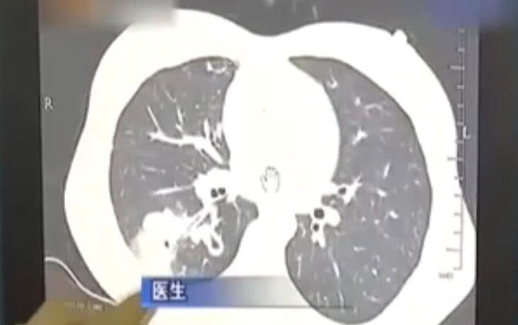 吃什么养肺补肺最快 eea20edb6ea847f4a0ecb5e5140c0bb4.jpeg