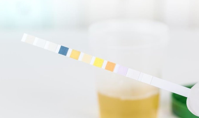 肾脏|肾炎有早期表现吗？肾内科主任：重视三处，不会太晚发现！