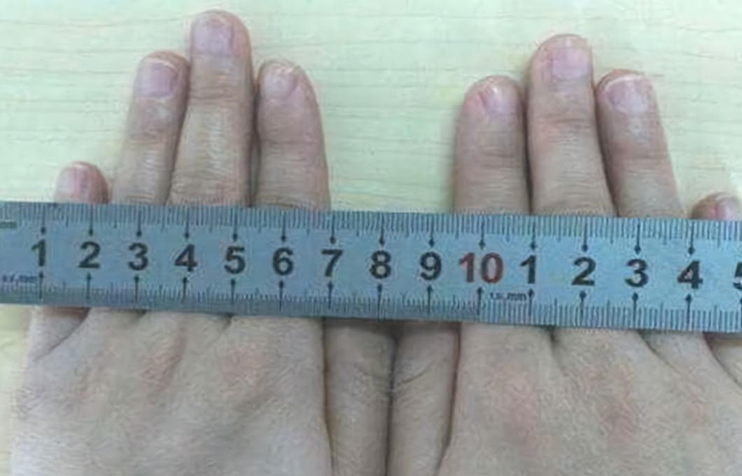 因为|分娩“开十指”有多大？孕妈：看完这几张图，对顺产都不紧张了