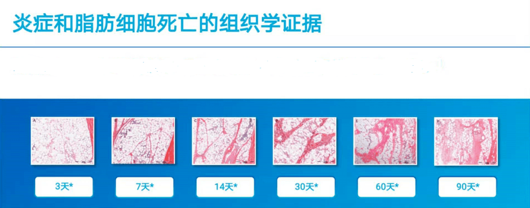 人群|黄金微雕、酷塑、美修斯、威塑 | 谁是下一个塑形之王？