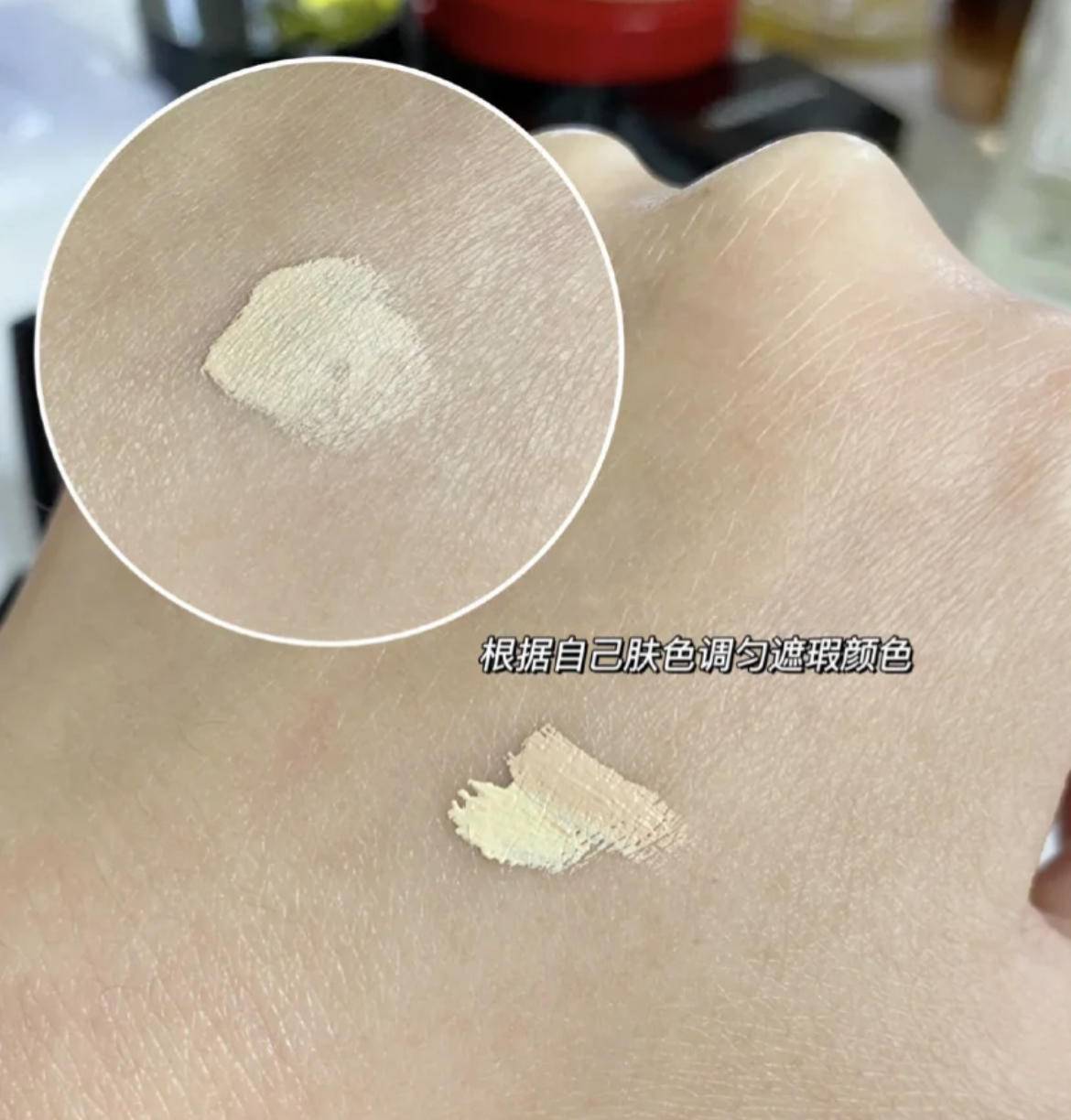 产品|万年的黑眼圈跟泪沟消失术！