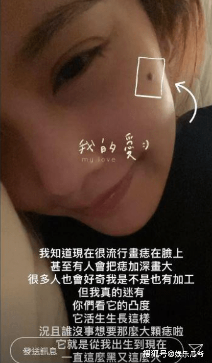 曹颖|脸上有痣也好看的几位女明星，不仅不影响颜值，反而更具特色