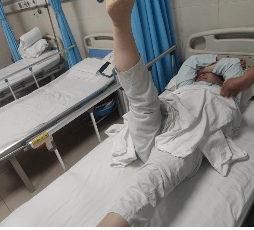 系列|PEID治疗巨大腰椎间盘突出症 ——脊柱微创手术系列