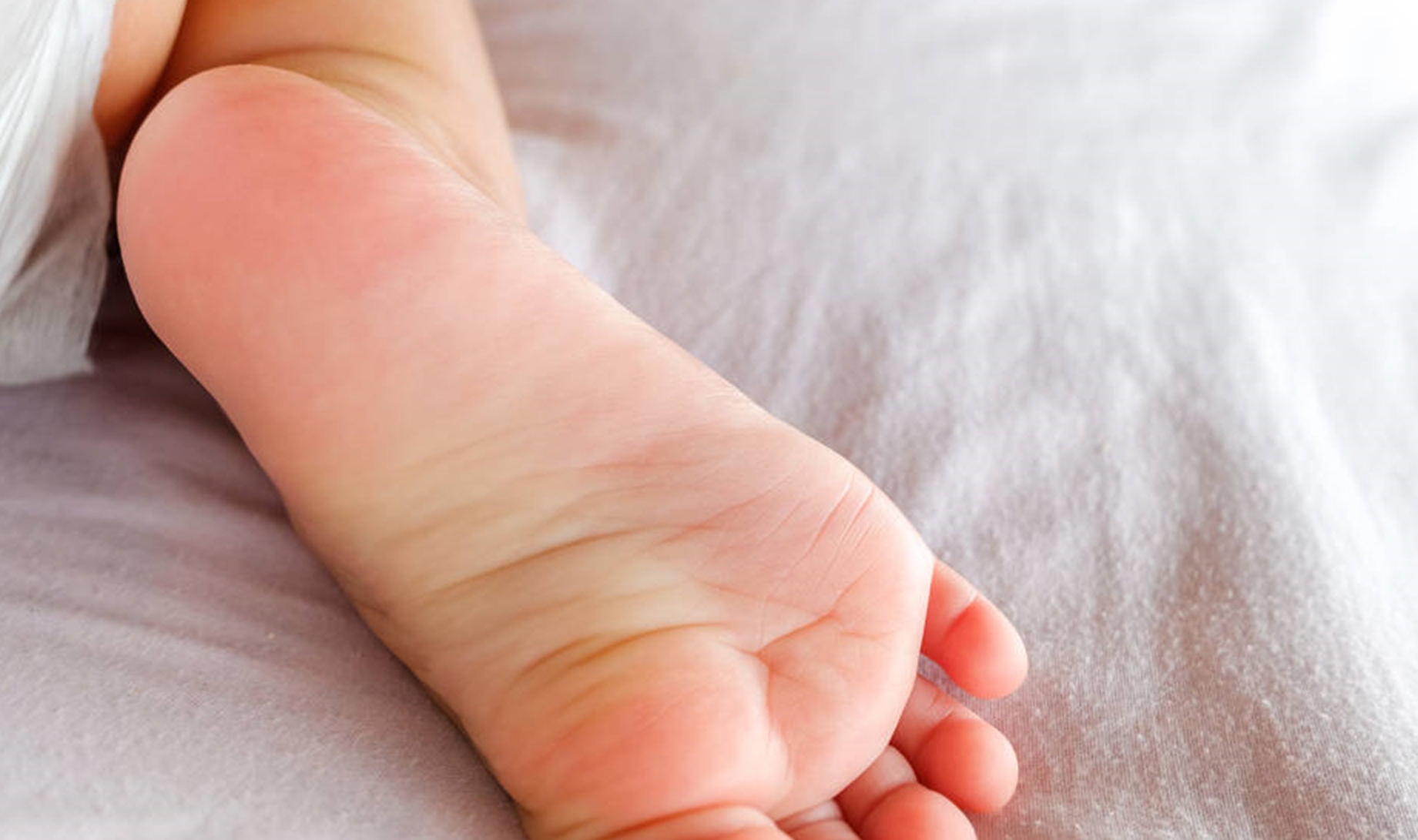 渔网|若脚上出现4个信号，肝已“烂如渔网”，尽快自查，不要忽视！