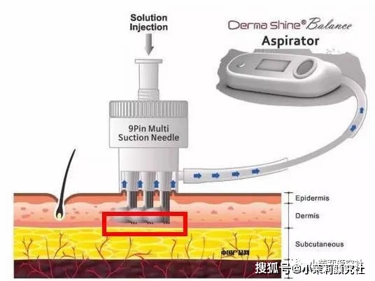 宁赛|色素暗沉？炎症痘痘？细纹敏感？有妃宁赛就够啦！！！