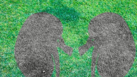 肾脏|水喝多了，真的会得尿毒症吗？看看医学专家怎么说