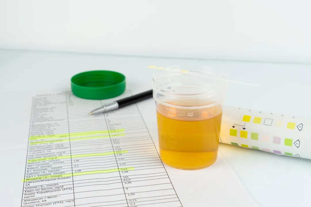 王奕暉|多飲多尿并非就是糖尿病，還可能...
