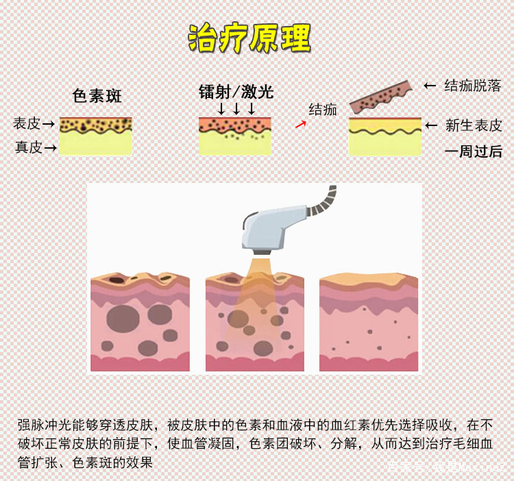 治疗|秋季美白大作战！