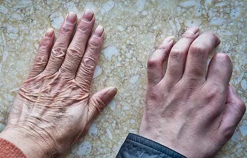 治疗|运动神经元病的主要治疗方法