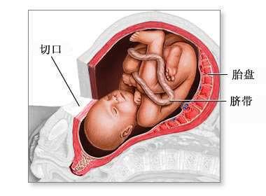 子宫|剖腹产二胎间隔时间多长，医生建议过了这个时间就不要生了