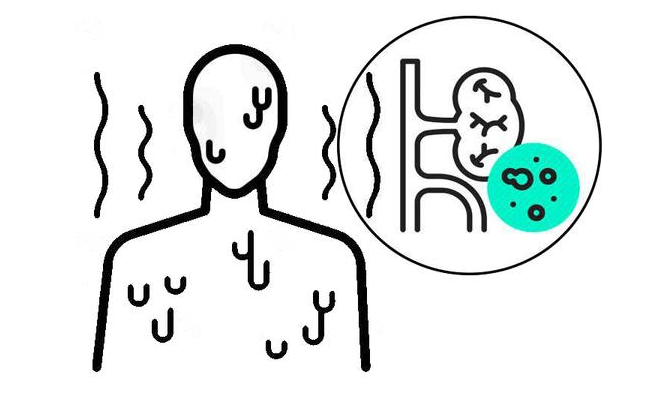 综合征|肾病综合症能活多久？医生坦白：生存长短，要看这2个因素