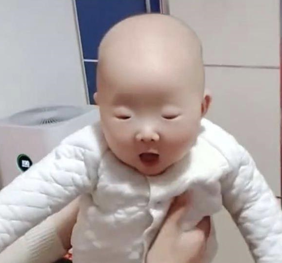 小孩子可以吃鱼眼睛吗 83648487977840e4a3c6c2e2890d3fe4.jpeg