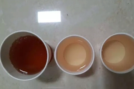 症状|尿酸高的人,若有这3种症状,肾脏可能已受牵连,早发现早治疗