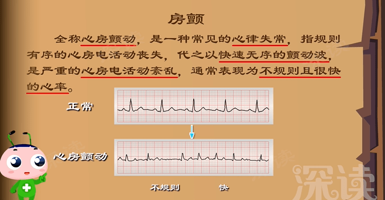 治疗|患者超1000万！心慌胸闷头晕？警惕脑中风！解密最常见的心律失常—房颤