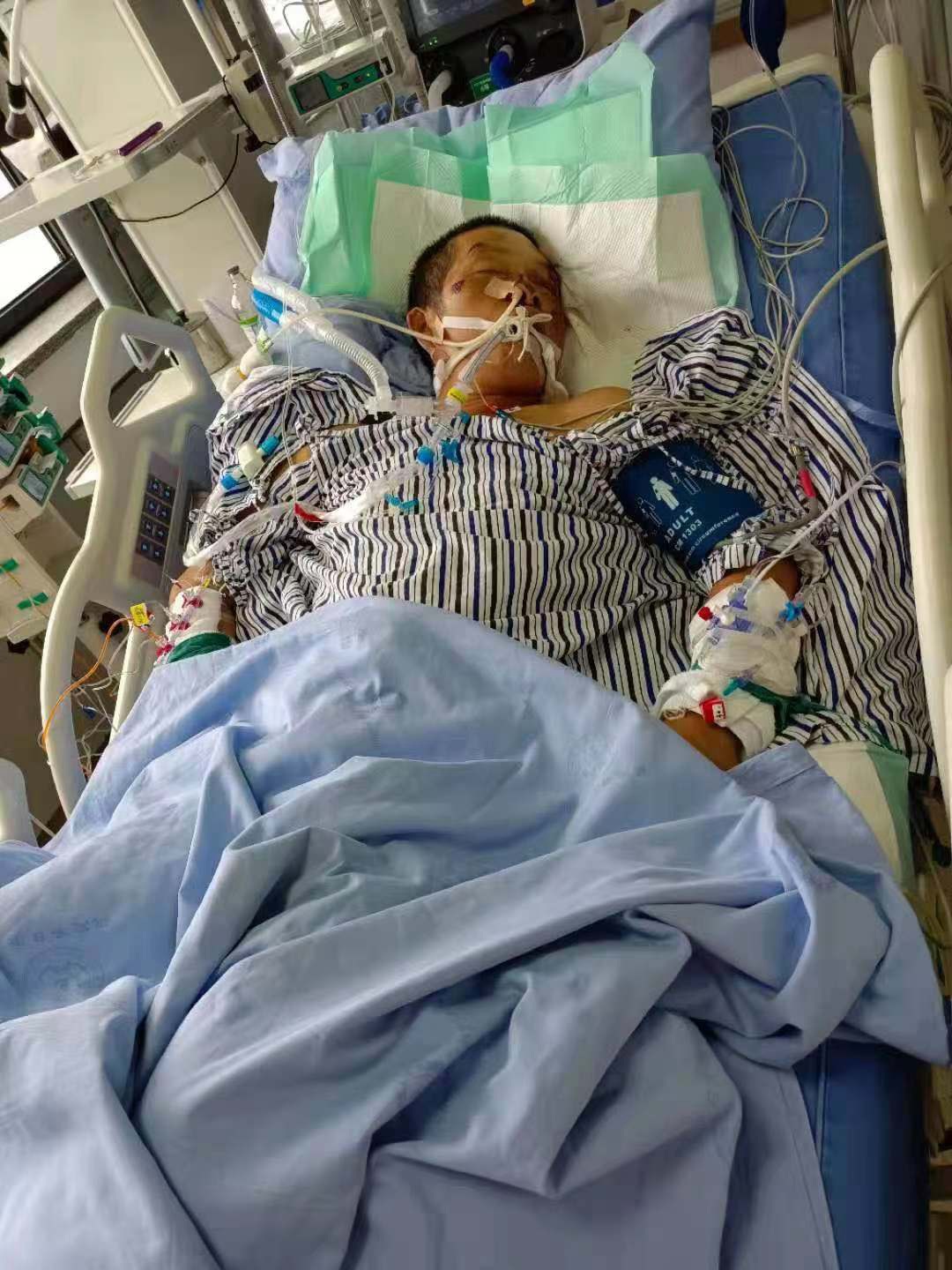 意外车祸令丈夫重伤昏迷仍未清醒,高昂治疗费用压垮农民工!