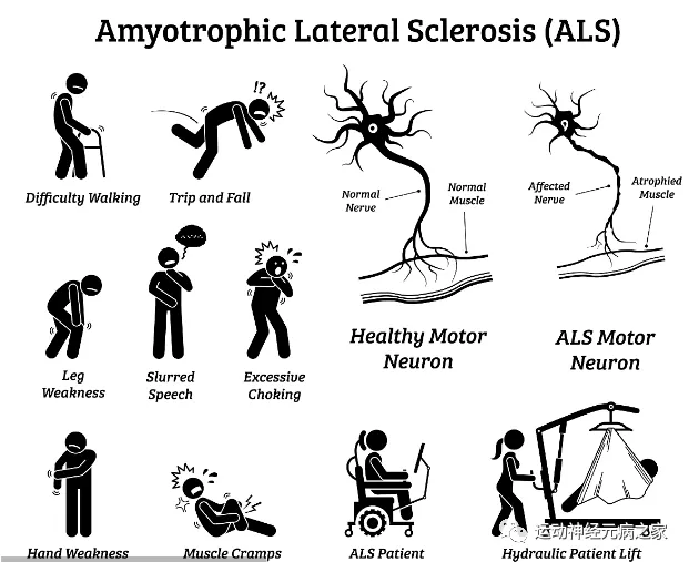 病患者|运动神经元怎么办？