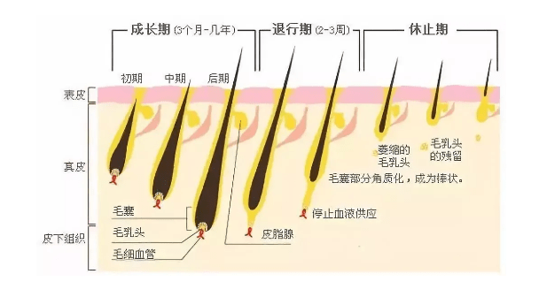 毛周|新依美脱毛：原来秋季脱毛的好处这么多!