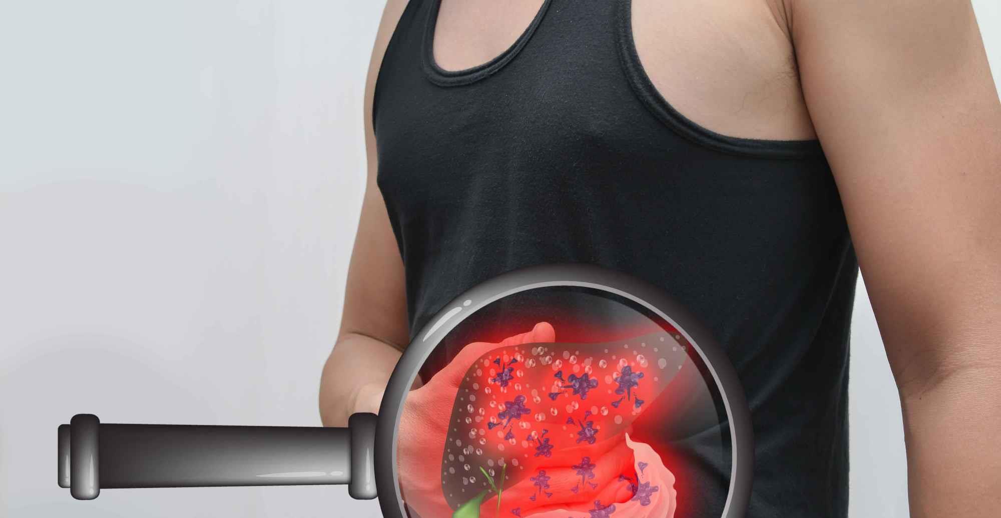 症状|一查就是肝硬化？肝病医生提醒：2个原因勿放过