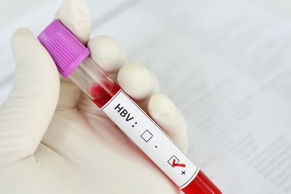 肝脏|如何预防乙肝复发?做好这4件小事,不给它留机会