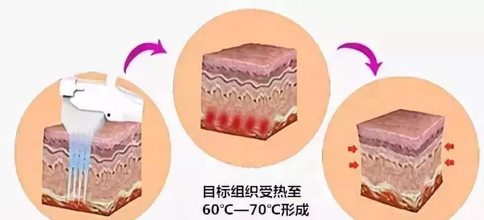 观点评论|延缓衰老让岁月“不留痕迹”