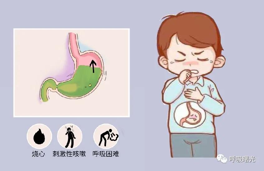 小儿胃食管反流的症状有哪些？