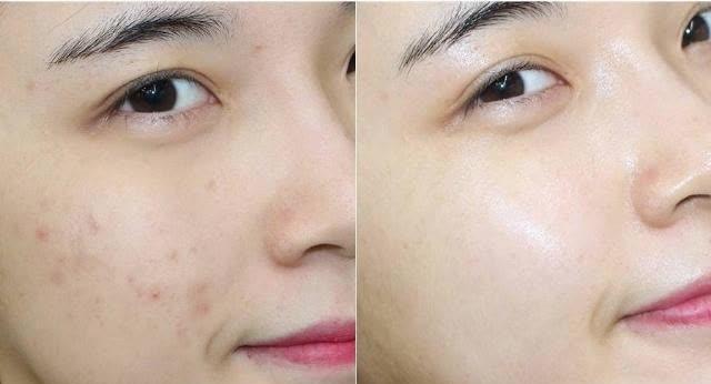 进行|女人婚后想要“干净”脸，建议这3件事做好，让你素颜也能很精致