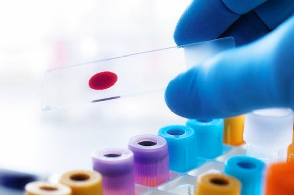 并发症|空腹血糖值9到10之间严重吗?你的理解真的对吗?看专家的理解