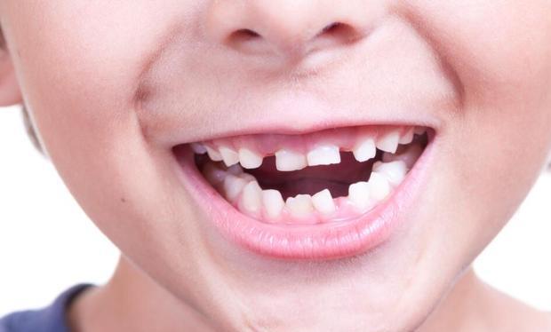 小孩几岁换牙 704341a8d18a4b5b8db916a8b0e0126f.jpeg