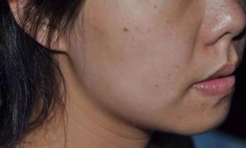 白发会|女人衰老前，身体已发出4种“警报”，不少人都没留意到，错过了最佳保养时期