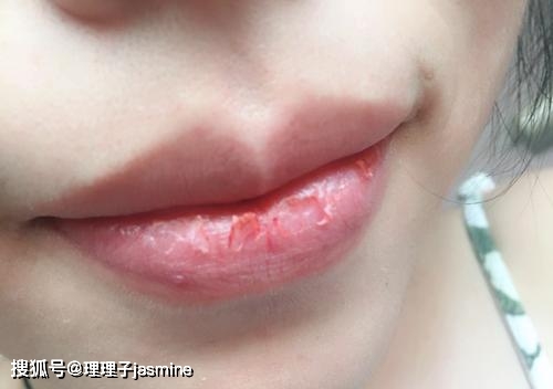 唇什么什么白成语_成语故事简笔画(2)