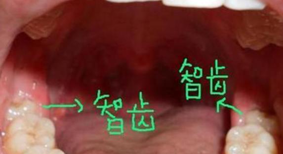 生活|人体的八个器官或可以“拿掉”，且不会影响正常生活，是真的吗？