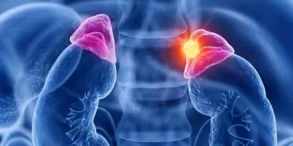 家属|男子胸痛以为心梗,家属聊天推翻了所有诊断,医生顿悟:水牛背