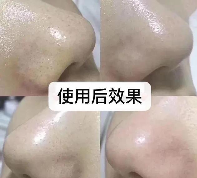 女士45岁阿姨每天小窍门洗脸，素颜下暴露“少女肌”，原来她是这么做