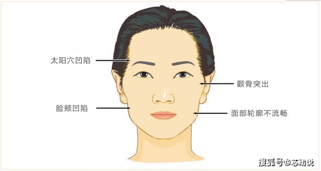 缺点|盘点10种常见的医美抗衰方法！