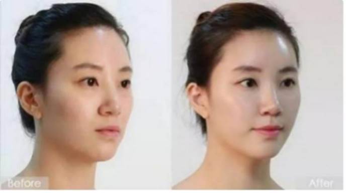 张雨绮伊能静夸张雨绮卸妆后皮肤“自带高光”,33岁的素颜看到我酸了