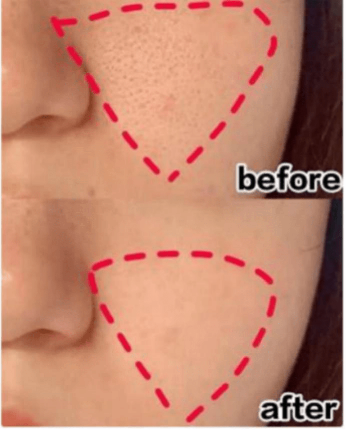 张雨绮伊能静夸张雨绮卸妆后皮肤“自带高光”,33岁的素颜看到我酸了