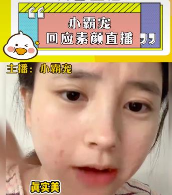 化妆品小霸宠首次透露素颜直播原因，审美跟大家不同，觉得满脸痘很好看
