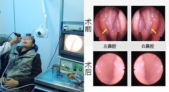 (点石师爷)王永月医生谈什么是鼻窦炎
