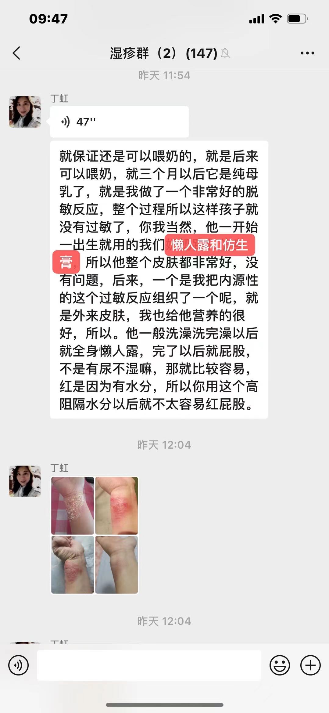 因为素简拾光:小孩子湿疹越来越严重应该如何护理?