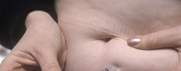 症状|4种人易患尿毒症，4个早期症状，平时留心易发现，早知早受益！