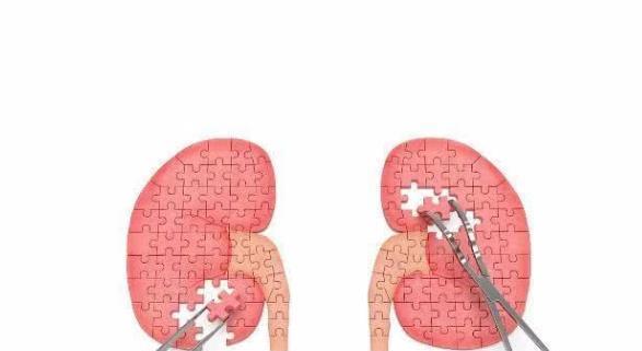 肾脏|男人“小便”,每天接近那个“数”,说明“尿毒症”离你很远