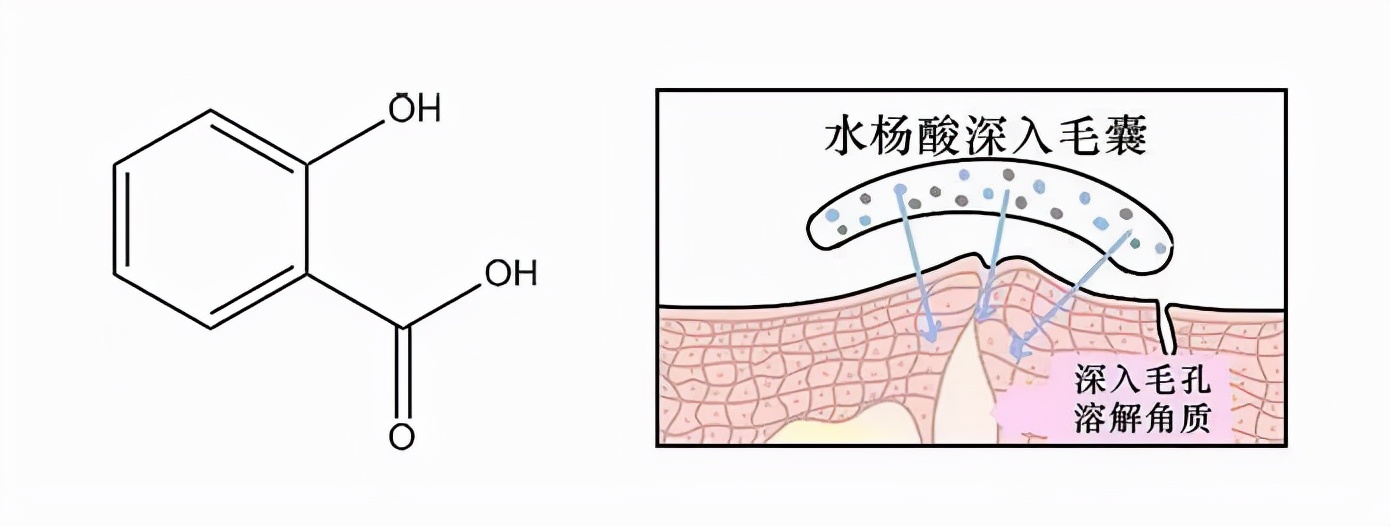 白活了stridex施顏適水楊酸棉片對皮膚還有這種作用