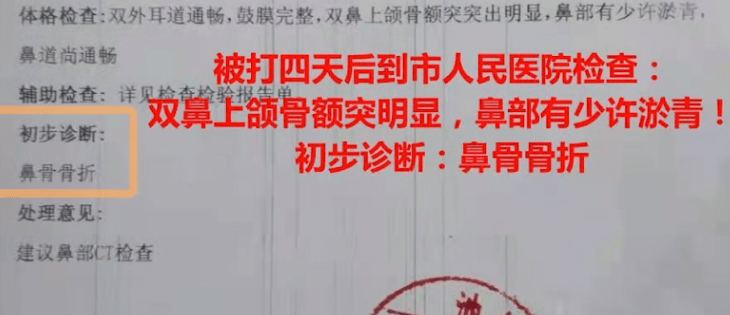 职业|安徽一幼儿园老师殴打3岁幼儿，致其轻伤鼻骨骨折，老师竟被留下