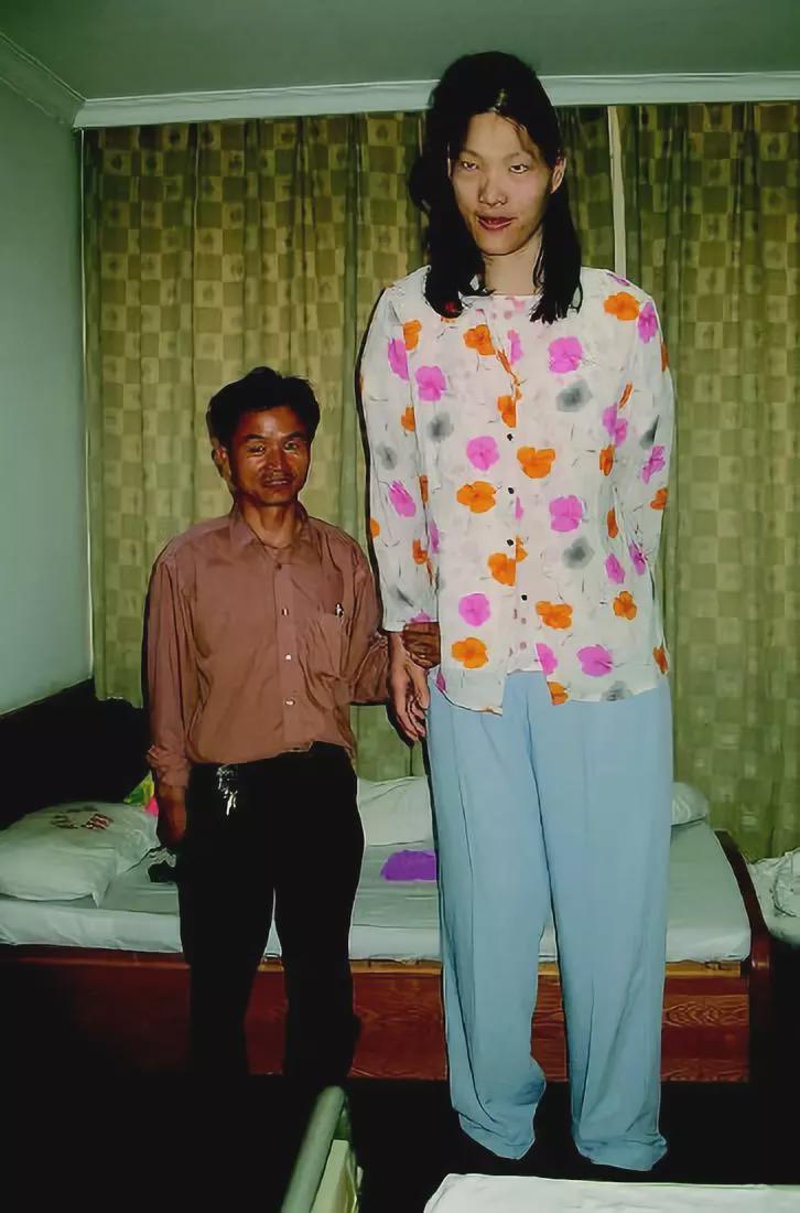 巨人姚德芬,安徽省舒城人,亚洲第一女巨人.身高2.