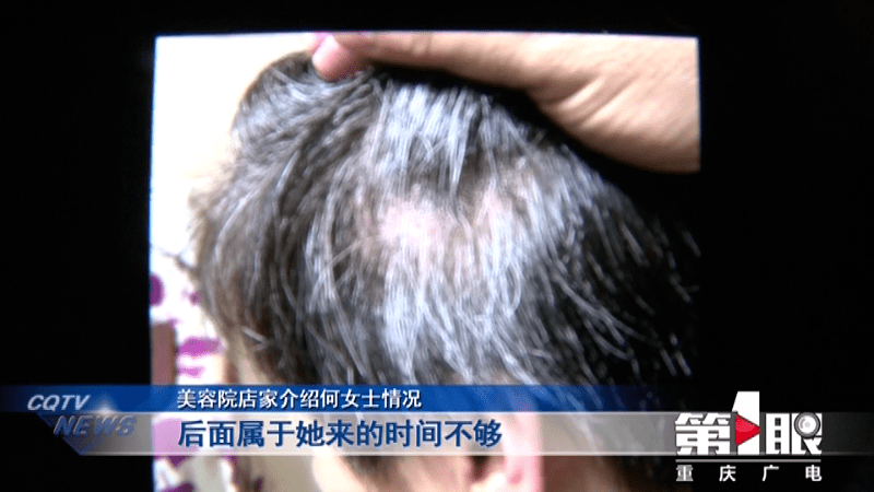 网友|女子花4万做“白发转黑”，结果治疗就是拔了白发