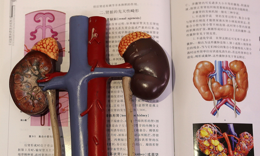 消耗|肾结石越来越多，医生再三劝告：3件事不注意，后悔也来不及！