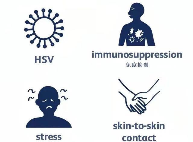 什么叫单纯疱疹 a1bcade645114f21a3564efc4627e72a.jpeg