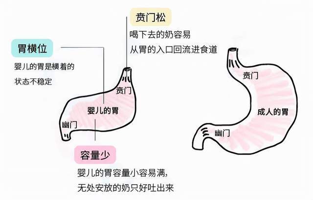 正是由于新生宝宝胃部的这种特点,再加上食管短,就容易让吃进去的奶再