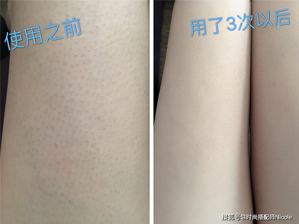 Nicole金晨“跳舞”又美上热搜！皮肤白到反光，大方分享自制“护肤法”
